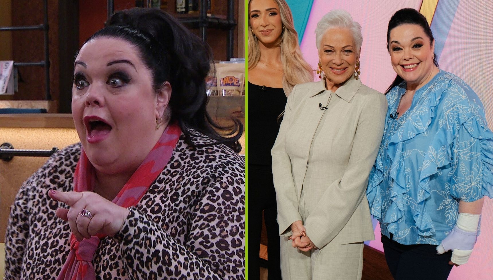 What happened to Lisa Riley's arm in real life as Mandy explains her injury